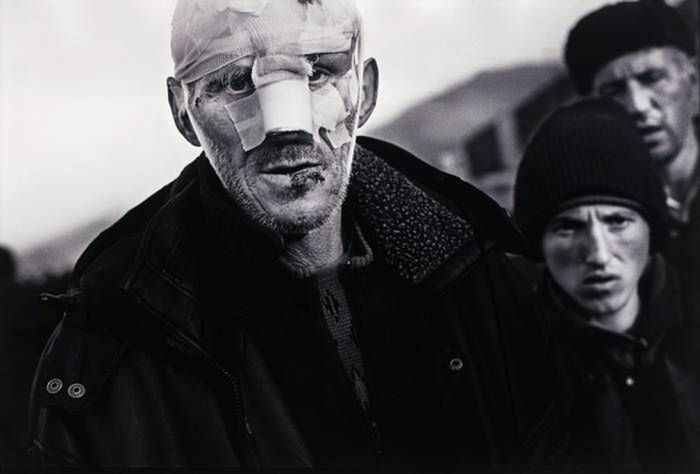 1999 r. Kukës, Albania. Mężczyzna w jednym z największych obozów dla albańskich uchodźców z Kosowa.
Fot. Claus Bjørn Larsen, World Press Photo of the Year