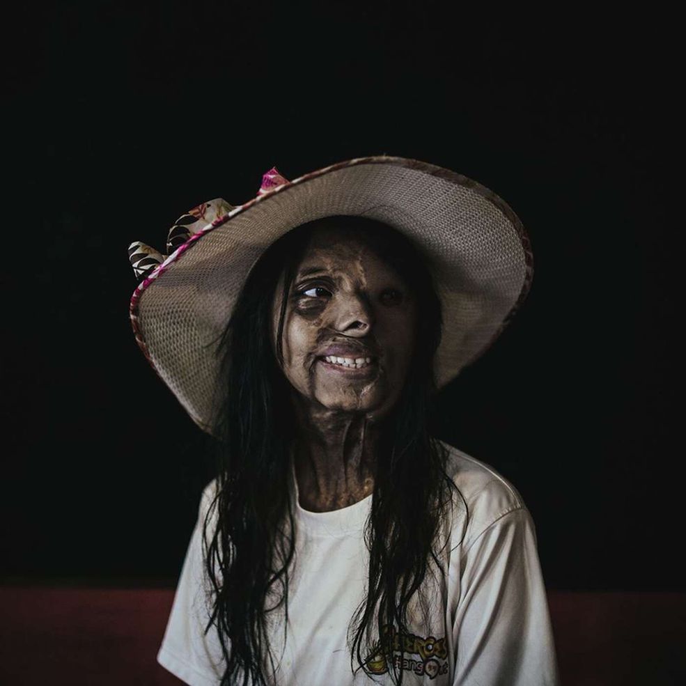Główną nagrodą „Photographer of the Year" został uhonorowany paryski fotograf – Zacharie Rabehi. Jego celem jest ukazywanie prawdy na zdjęciach, natomiast jego marzeniami od zawsze było podróżowanie i dokumentowanie świata.
Fotograf odnalazł się w Indiach, dokąd przeprowadził się w 2008 roku. Praca, która zapewniła mu nagrodę, przedstawia kobietę, która przeżyła oblanie kwasem w wieku zaledwie miesiąca życia. Napaść zabiła matkę Shaboo, przedstawionej na zdjęciu. Te okrutne ataki są niesamowicie popularne w okolicach Indii, Pakistanu oraz Bangladeszu.
Anthony Holland Parkin z Getty Images powiedział o zwycięzcy: „Zacharie Rabehi zaprezentował ogromny talent i fotoreporterską perfekcję w swojej dotychczasowej pracy przez opowiadanie ważnych historii, różnorodność i zdecydowanie chciałbym z nim pracować w ramach jego przyszłej kariery”.