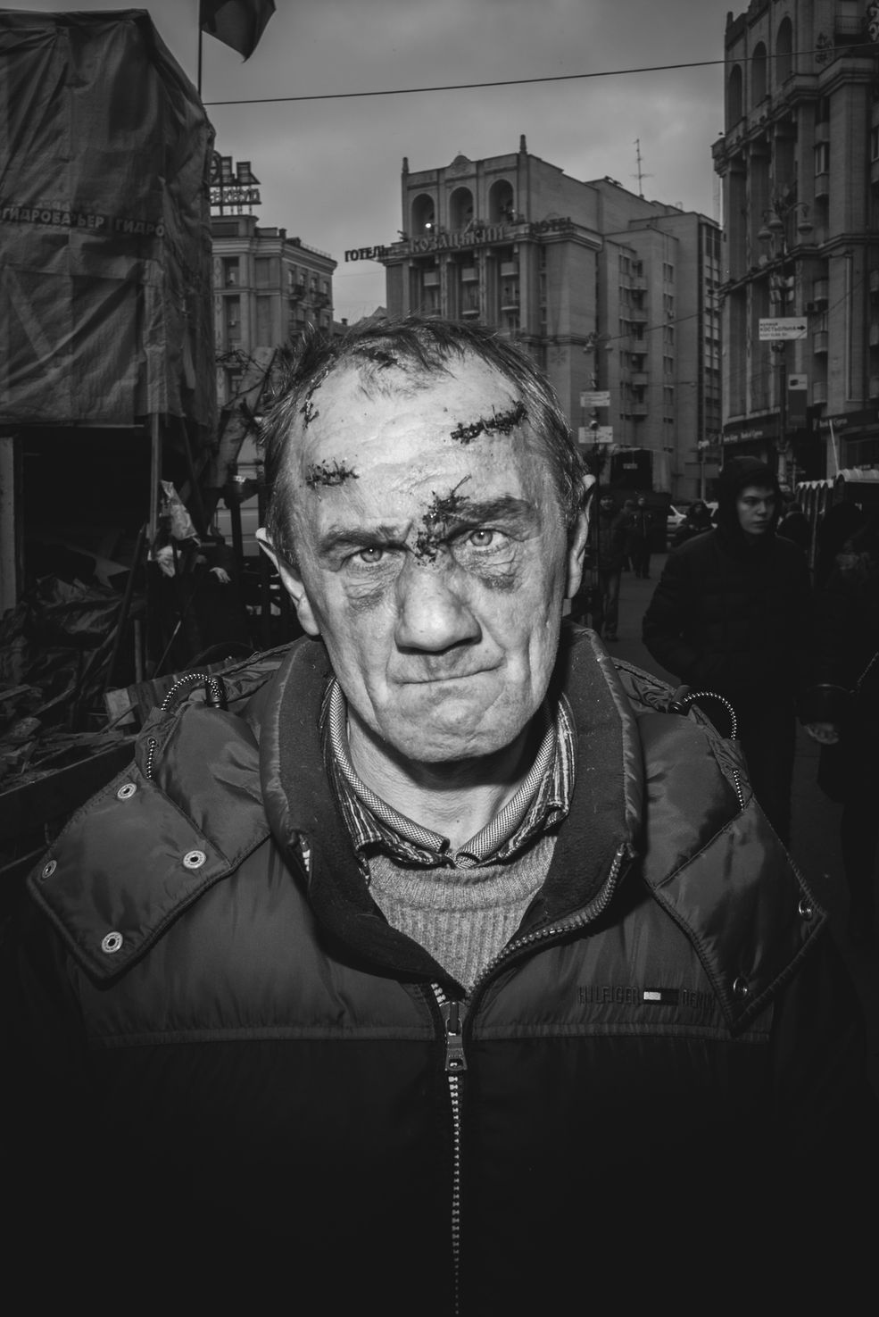 Zdjęcie pojedyncze - II miejsce w kategorii PORTRET SESYJNY
Kijów. Po tragicznych wydarzeniach z tzw. czarnego czwartku 20 lutego 2014 roku, gdy siły rządowe i snajperzy strzelali do demonstrantów, zabijając ok. 70 osób, obywatele Ukrainy składali hołd poległym bohaterom. Zdjęcie pochodzi z cyklu portretów ludzi opłakujących ofiary – uczestnik walk na barykadach został opatrzony w szpitalu polowym i wrócił na Majdan Niepodległości, gdzie pomagał nosić trumny z ciałami poległych. 25 lutego 2014 roku.