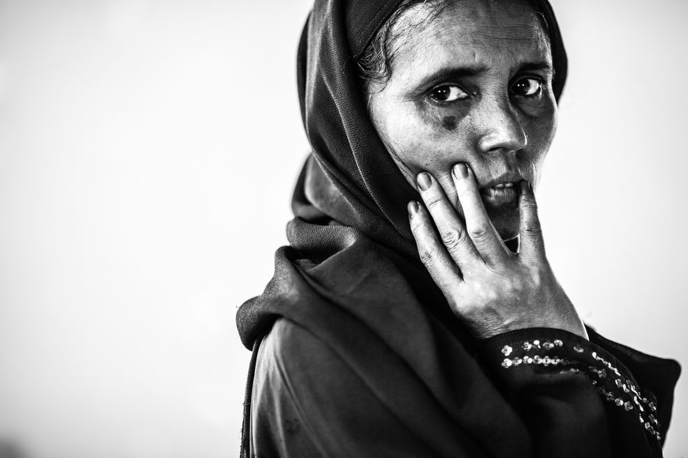 Zdjęcie pojedyncze - III miejsce w kategorii PORTRET SESYJNY
Cox Bazar, Bangladesz. Dala Banu, 44 lata, numer obozowy REC 38. Uchodźca z obozu Kutupalong. W obozie gang zgwałcił zbiorowo jej 23-letnią córkę, dzięki wsparciu UN udało się jej wyjechać do Kanady. Dala Banu, jej mąż i pozostałe pięcioro dzieci są biedni, nie mają pieniędzy na wyjazd z obozu ani odwiedziny córki w Kanadzie. 18 października 2013.
