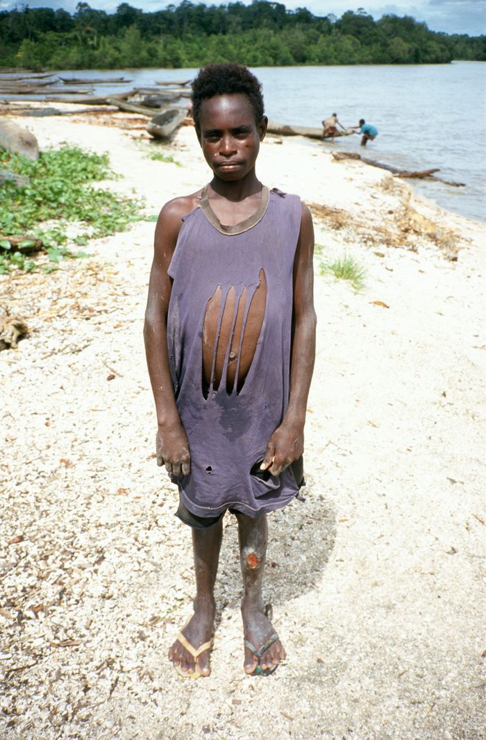 12 Roy Villevoye, Andreas Saráw, Pirimapún, Asmat, Papua 1998
C - print ze slajdu, 190 x 125 cm
Dzięki uprzejmości Motive Gallery, Bruksela, Belgia