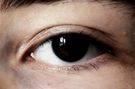 Co oczy mówią o twoim zdrowiu? (WIDEO)