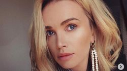 Wypadanie brwi to objaw niedoczynności tarczycy #ZdrowaPolka