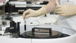 Wskaźnik eGFR - jak przebiega badanie eGFR, wskazania do badania, choroby, norma