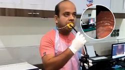 Lekarz sam sobie zrobił gastroskopię. Nagranie dla widzów o stalowych nerwach