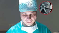 Przez 30 lat miała zatkany nos. Lekarze zamarli, gdy odkryli przyczynę