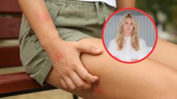 To warzywo trzymaj w kuchni. "Dobra, np. na ukąszenia po pszczołach"