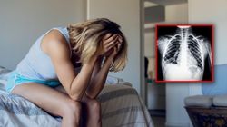 Nigdy nie paliła. Tak u 32-latki objawił się nowotwór płuc