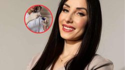 Popularne zabiegi upiększające wśród Polek. Nawet gwiazdy nie uniknęły powikłań