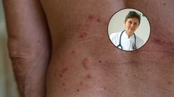 Zachoruje co trzeci po 50-tce. "Objawy są bardzo dotkliwe"