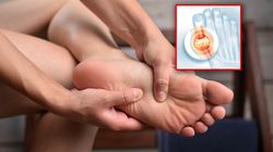 Dna moczanowa to nie kara za obżarstwo. Duże badanie pokazuje, skąd się bierze