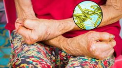 Pierwszy od ponad 40 lat przypadek trądu w Rumunii. Cztery kobiety pod nadzorem epidemiologicznym