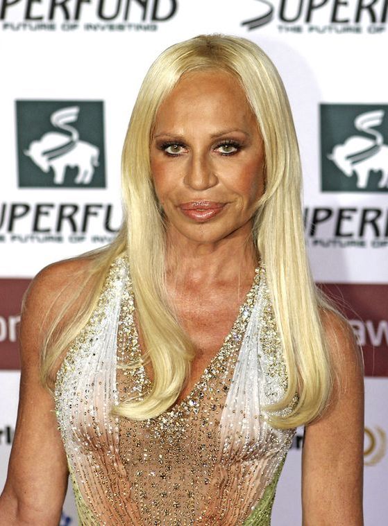 Dra. Patrícia Leite Nogueira - As três fases de Donatella Versace. As três  FASES e as três FACES. ⠀⠀⠀⠀⠀⠀⠀⠀⠀⠀ Em um 1o momento fico me perguntando como  alguém como a da 1a