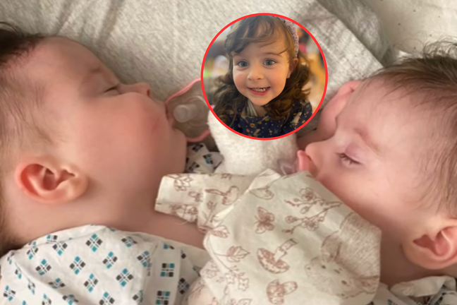 Born Joined, Separated by 30 Medics - News Directory 3