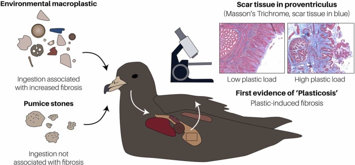 plastikoza