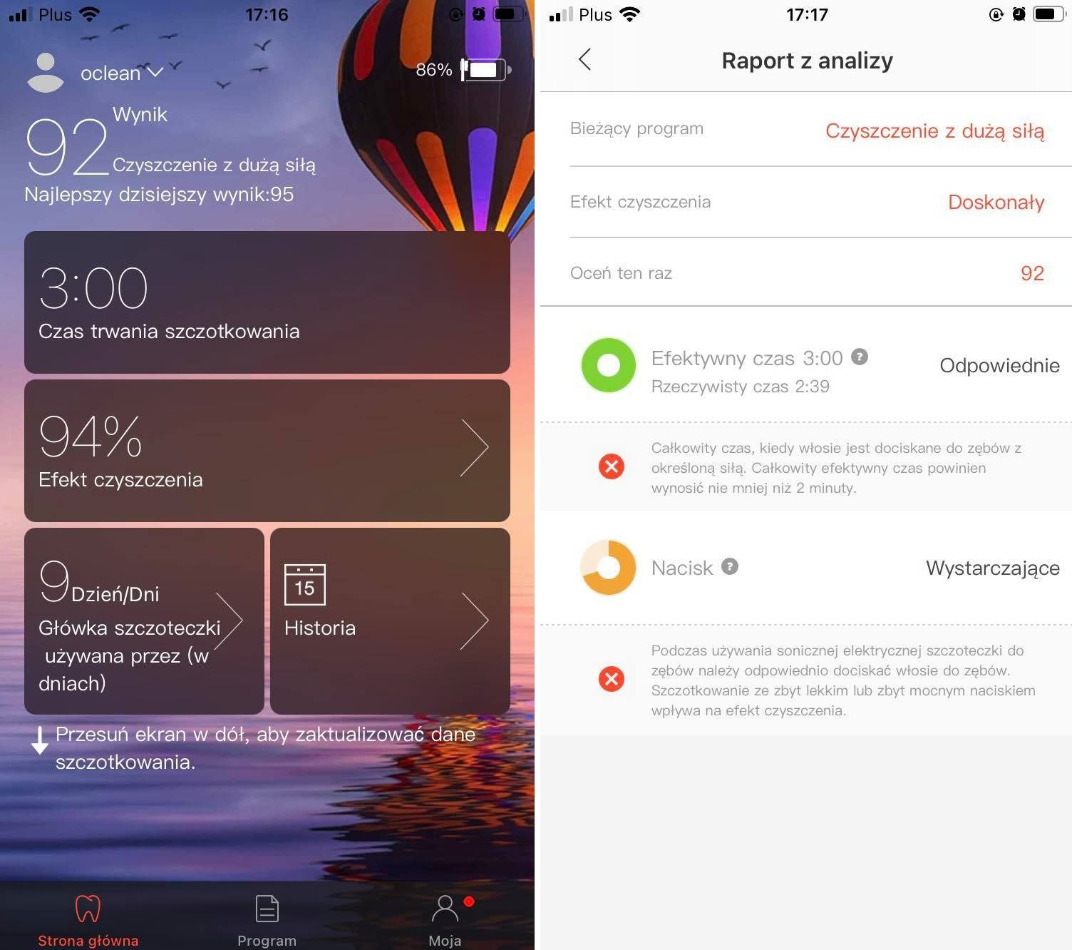 Raport z mycia zębów Oclean X Pro Elite