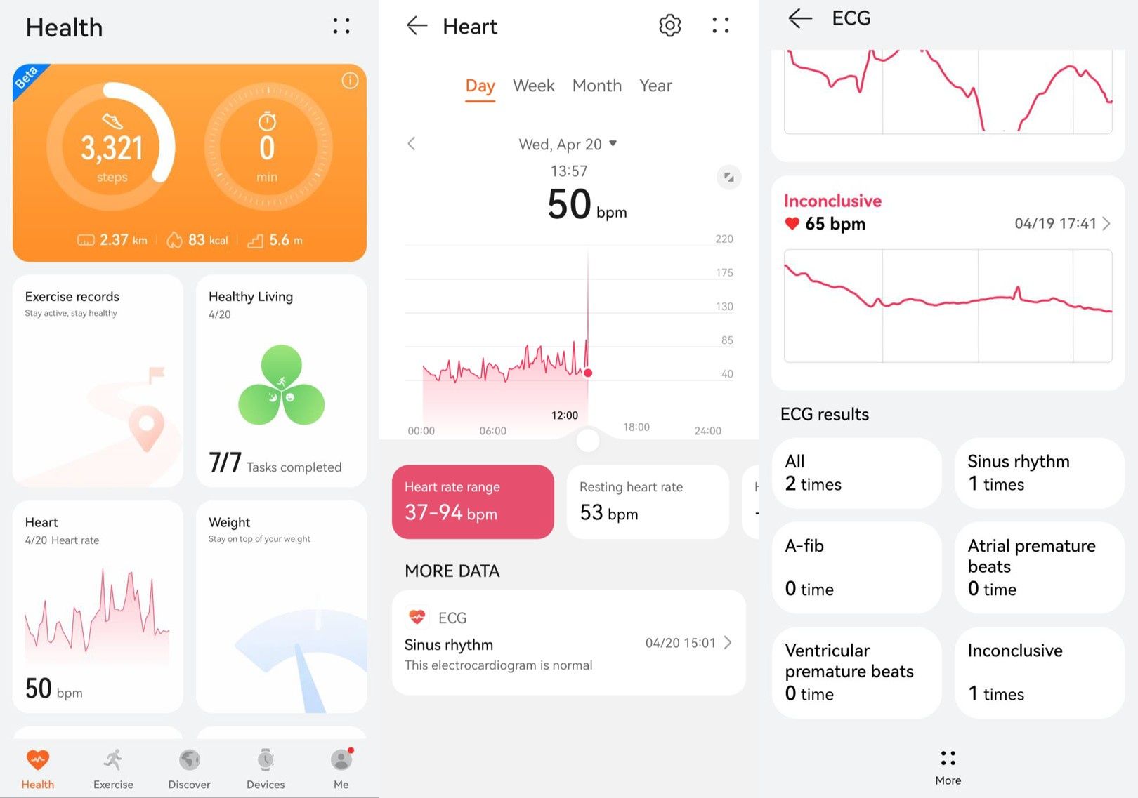 Huawei Health ECG