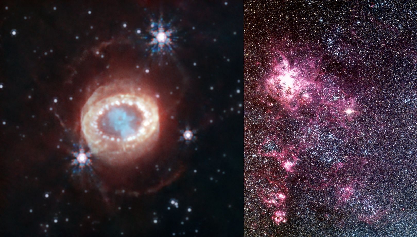 SN1987A