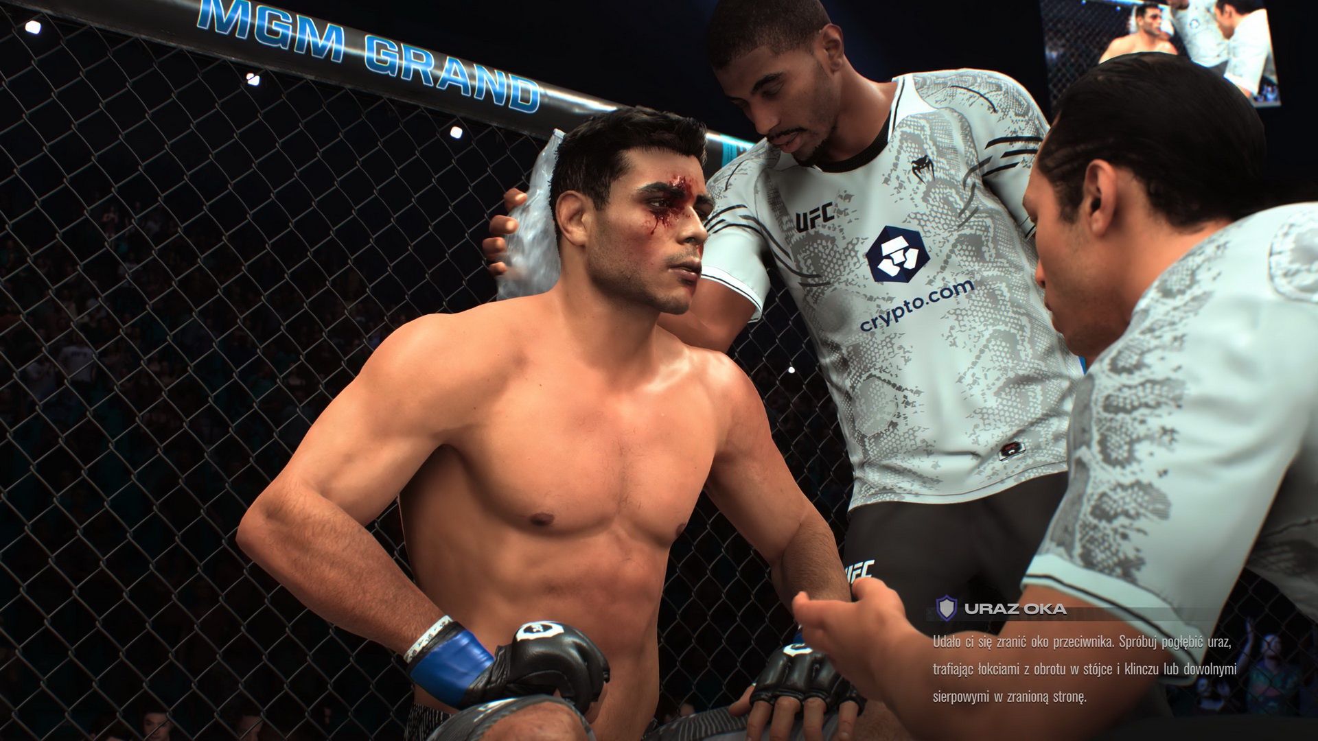 EA Sports UFC - uszkodzenia twarzy