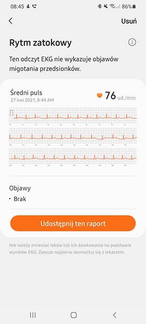 wykres EKG