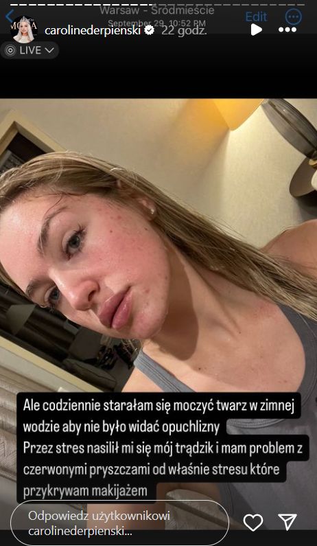 Instagram / CarolineDerpienski