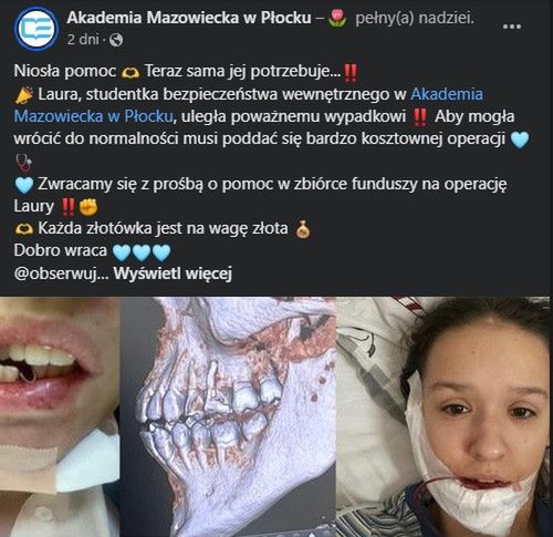 Studentka z Płocka potrzebuje pomocy - uległa poważnemu wypadkowi!