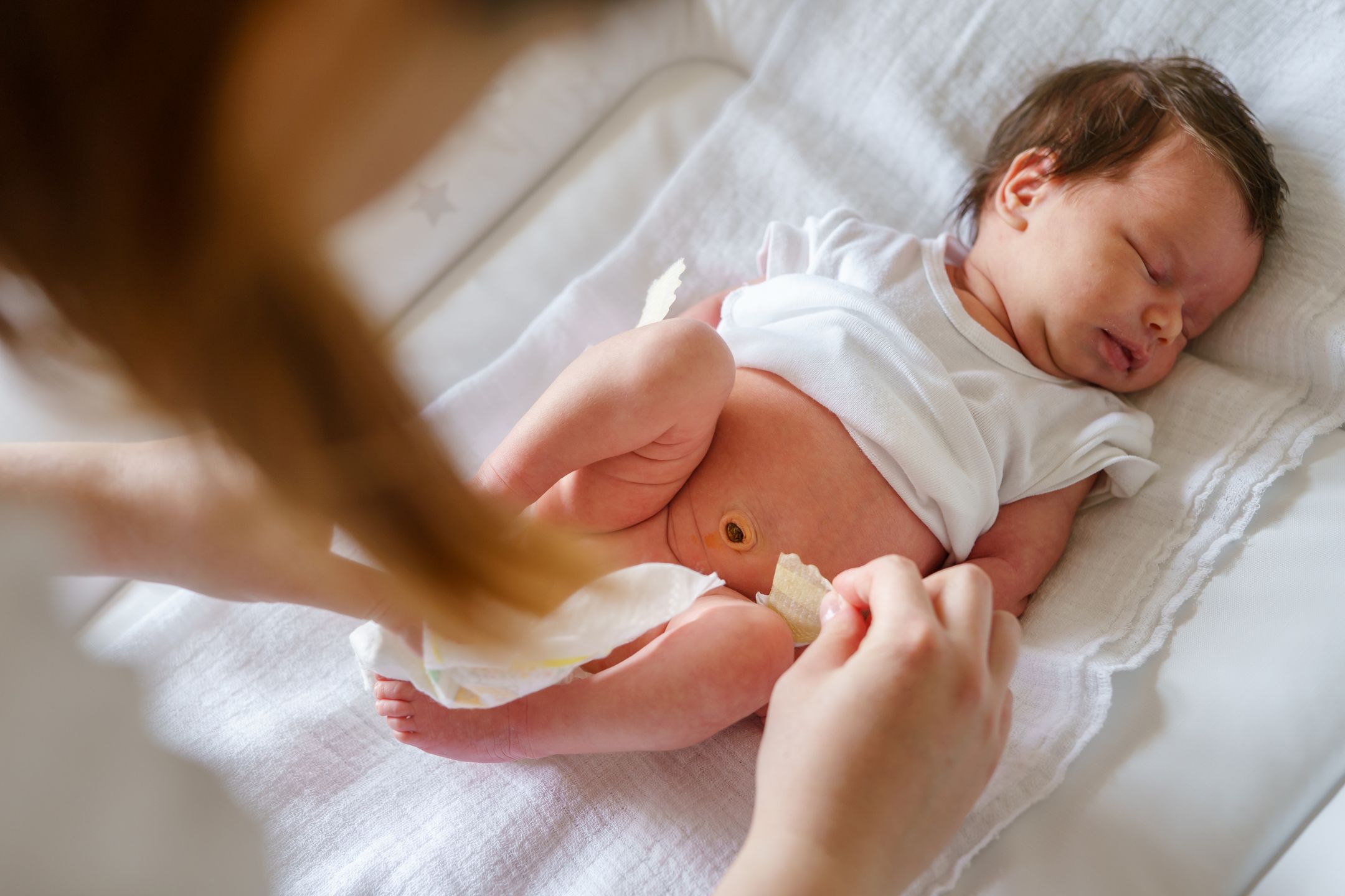 Podstawową zasadą przy dbaniu o kikut pępowiny jest utrzymywanie go czystym i suchym. Należy przemywać go min. raz dziennie i pozostawiać do wyschnięcia. W ciągu dwóch tygodni kikut powinien odpaść. 