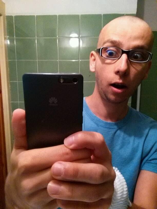 Marcin w trakcie leczenia