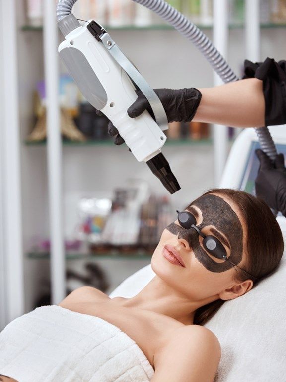 laserowy peeling węglowy w salonie kosmetycznym