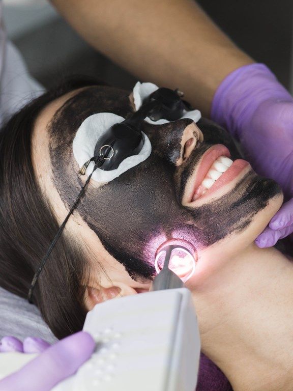 laserowy peeling węglowy w salonie kosmetycznym
