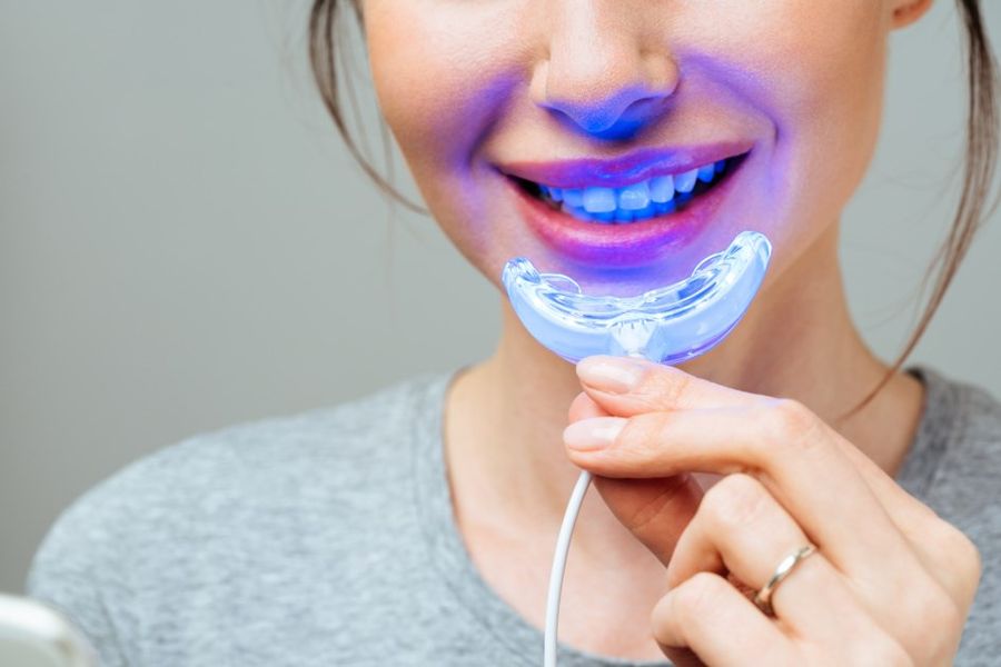 wybielanie zębów w domu lampą led