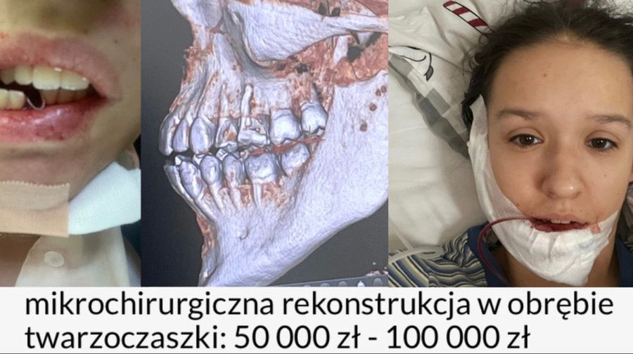 Studentka z Płocka potrzebuje pomocy - uległa poważnemu wypadkowi!